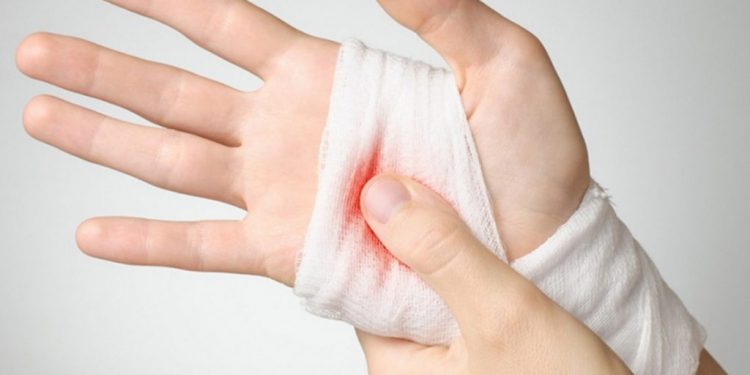 У Тернополі чоловік після сварки з мамою порізав собі лезом руку