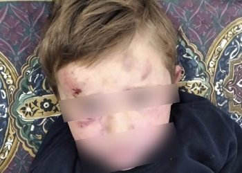 На Тернопільщині судитимуть вітчима, який знущався з дитини: зламав руку і кинув об землю