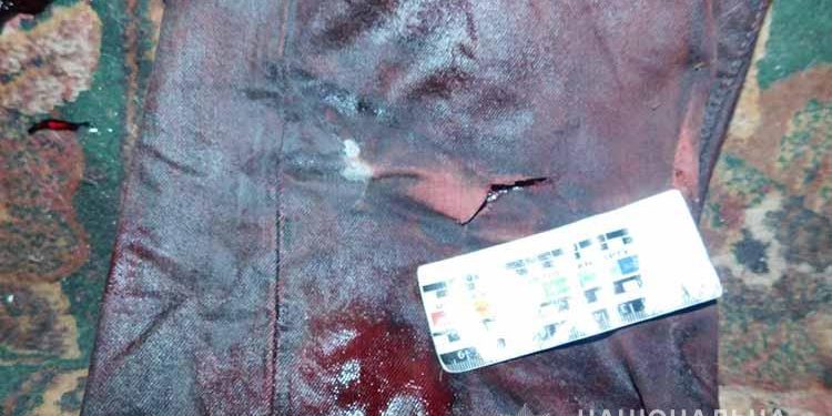 У Тернополі жінку підозрюють у вбивстві чоловіка: узяла ніж і встромила у ногу (Фото, Відео)