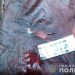 У Тернополі жінку підозрюють у вбивстві чоловіка: узяла ніж і встромила у ногу (Фото, Відео)