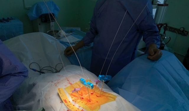 У Тернополі, завдяки унікальній операції, лікарі врятували життя 65-річній жінці