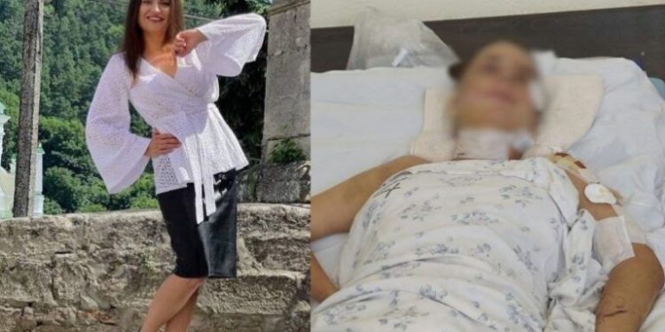 “Будемо молитися”, – лікарі рятують дівчину з Кременця, яка сильно постраждала у ДТП дорогою в Київ (Фото)