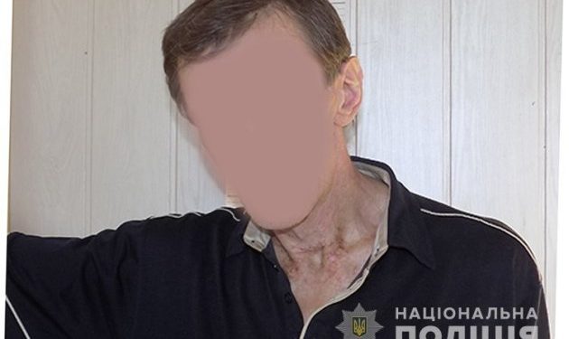 У Тернополі затримали серійного злодія (Фото)