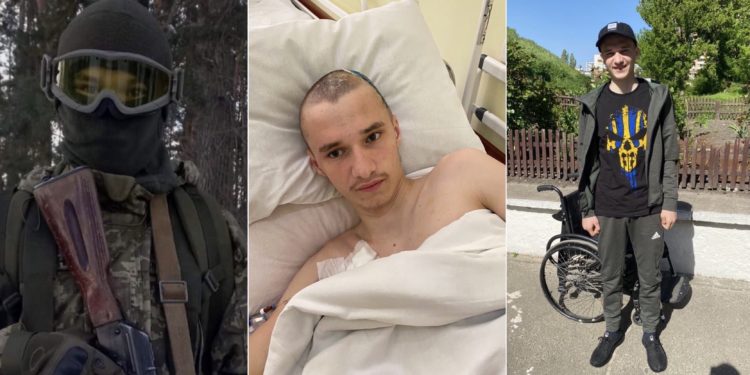 У голові залишилися осколки: важкопораненому 19-річному бійцю з Тернопільщини потрібна допомога