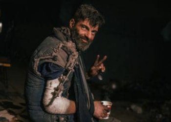 У героя Маріуполя не вистачає 4 см кістки в руці: як виглядає звільнений з полону морпіх Михайло Діанов