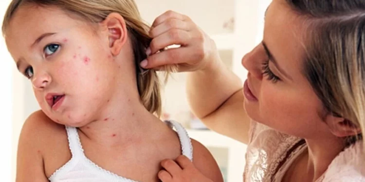 В Україні швидко поширюється небезпечний дитячий вірус: медики Тернопільщини закликають вакцинуватися