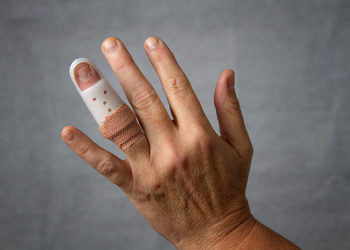 У Тернополі підліток зламав пальця поліцейському