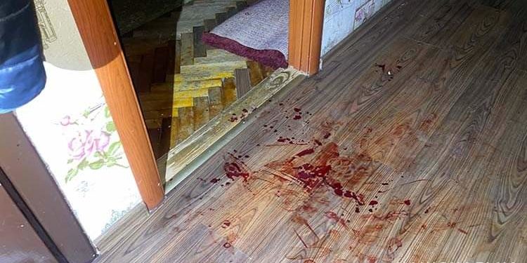 У Тернополі затримали чоловіка, який на очах у 6-річної дитини, ножем поранив дружину