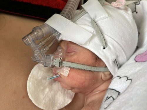 У Тернополі показали, як виходжують дітей, які народилися з вагою, менше 1 кілограма