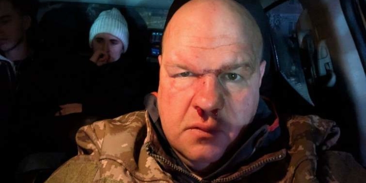 У Кременці мажори жорстоко побили майора ЗСУ