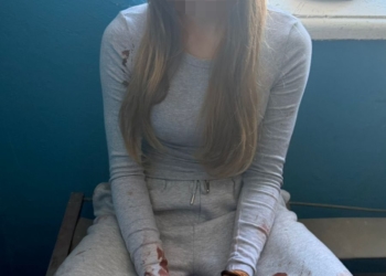 Ножове поранення школярки у Тернополі: 15-річній підозрюваній інкримінують замах на вбивство, слідство перевіряє версію булінгу